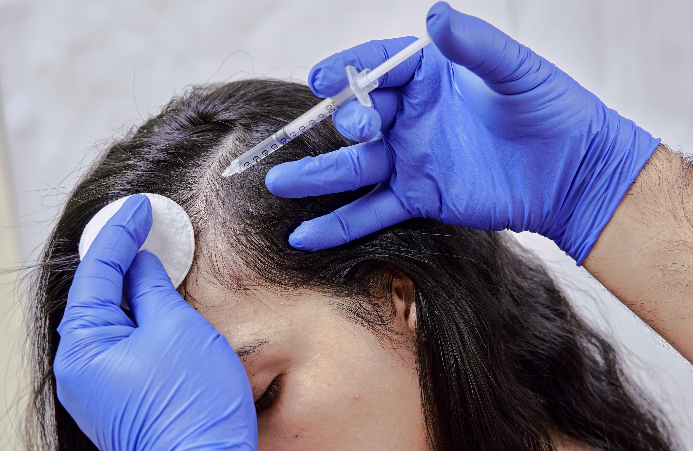 Best Hair Doctor in Himayat Nagar Hyderabad Reflect Skin and Hair Clinic 2 1