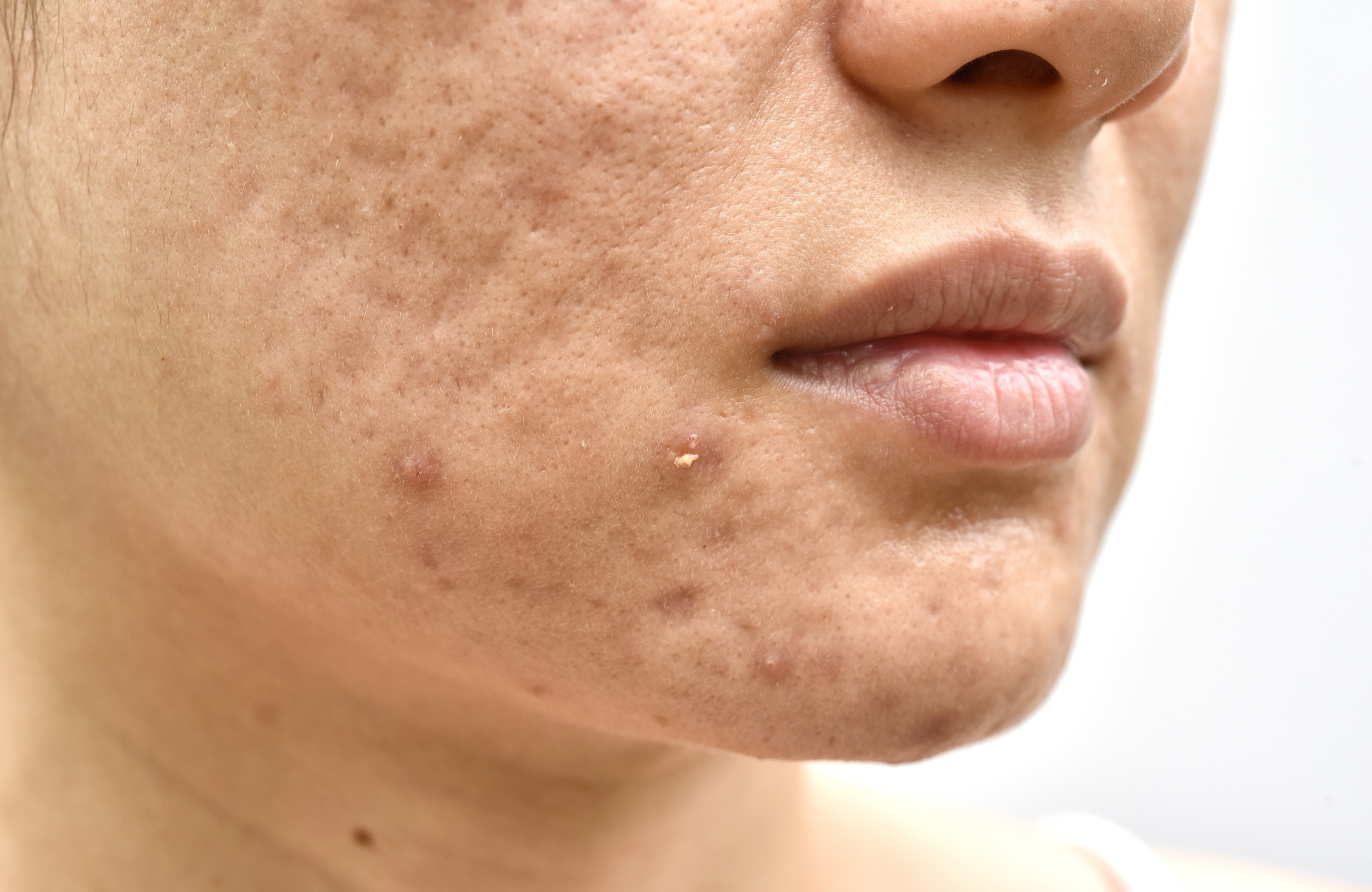 Skin & Hair Problems Common in Himayatnagar
