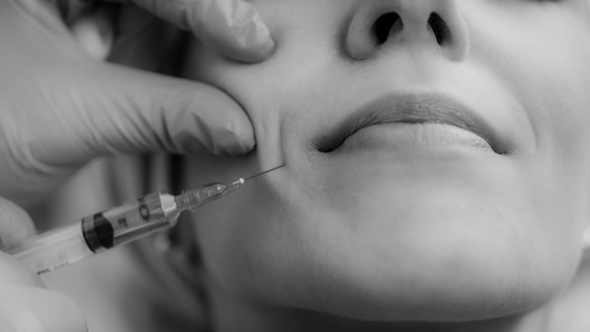 How to Choose the Best Dermatology Clinic in Himayatnagar for Your Skin Concerns